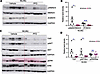 Effect of PFD on profibrotic cell signaling.