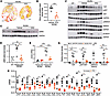 Effect of PFD on fibrosis in female RC/RC mouse kidneys.