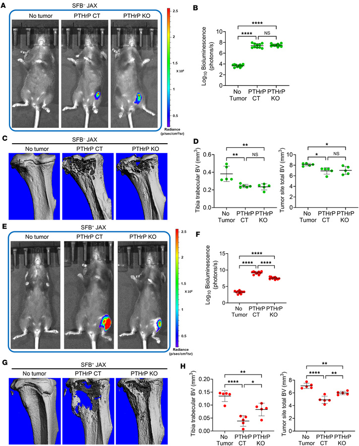 Bone tumor growth in SFB– JAX mice and SFB+ JAX mice injected with PTHrP...