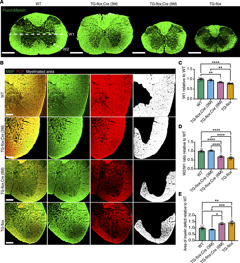 Reduction of hLMNB1 in Tg-flox;Cre (3M) leads to protection from spinal ...
