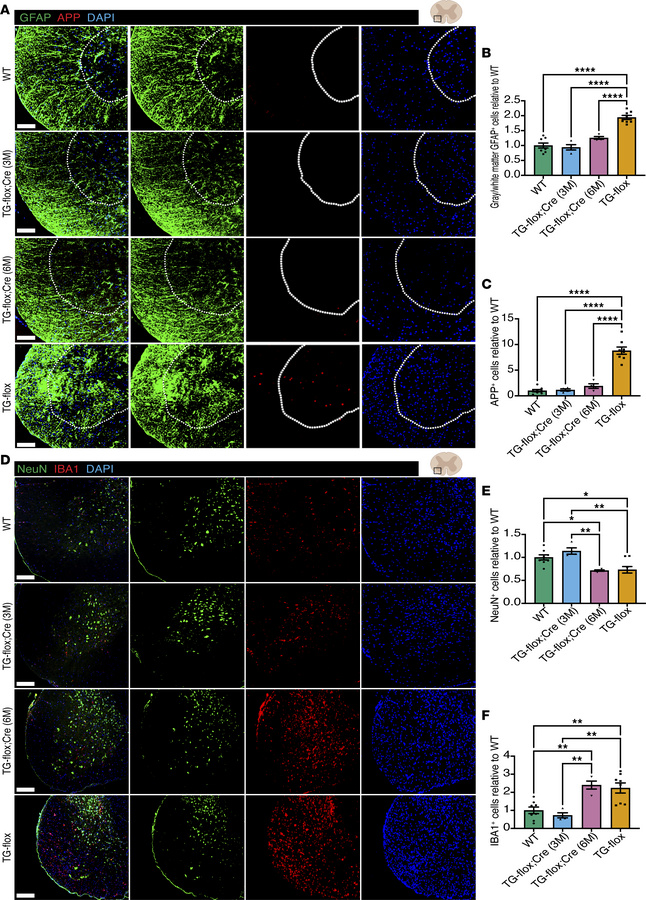 Reduction of hLMNB1 reduces proinflammatory signaling in Tg-flox;Cre (3M...
