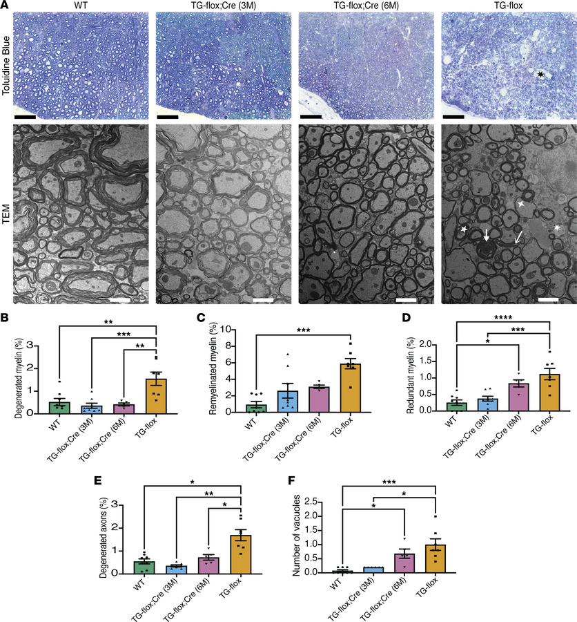 Reduction of hLMNB1 decreases axon abnormalities for both Tg-flox;Cre (3...