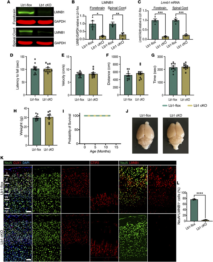 Ubiquitous knockout of Lmnb1 in adult mice does not impair motor functio...
