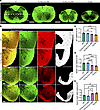 Reduction of hLMNB1 in Tg-flox;Cre (3M) leads to protection from spinal cor