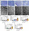 Reduction of hLMNB1 decreases axon abnormalities for both Tg-flox;Cre (3M)