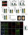 Ubiquitous knockout of Lmnb1 in adult mice does not impair motor function,