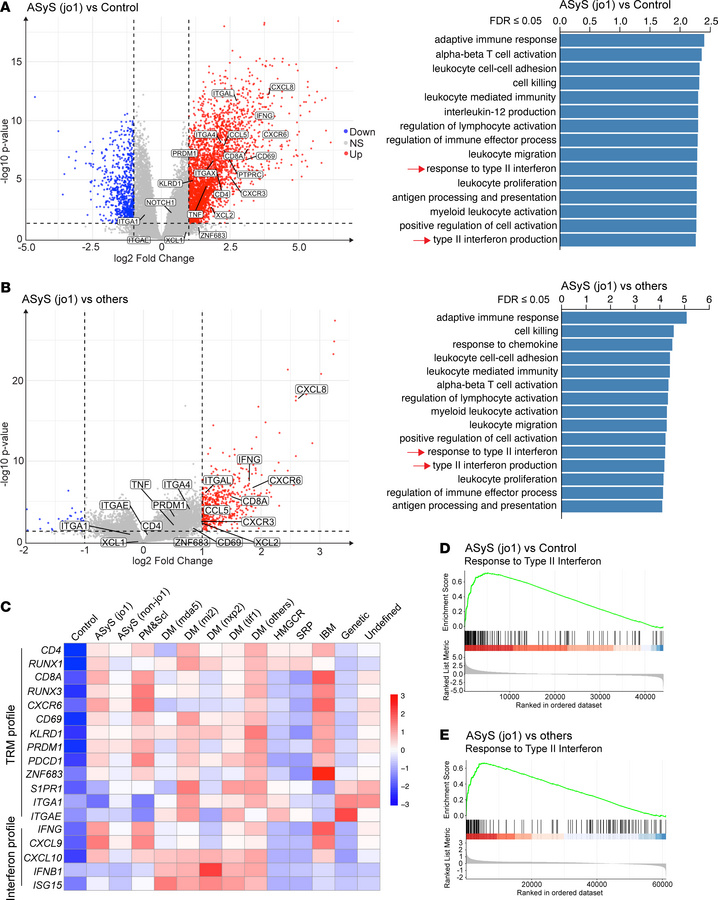 Bulk RNA sequencing analysis of human myositis biopsy specimens.
(A) Lef...