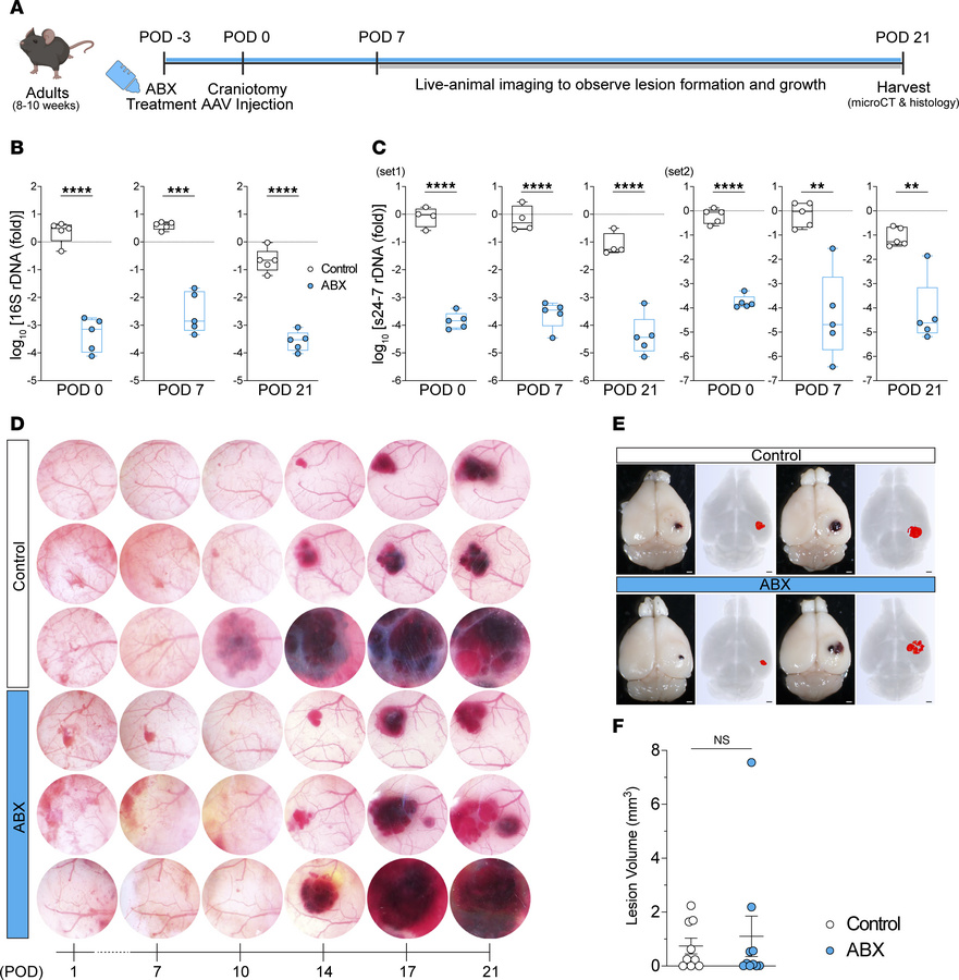 Antibiotic treatment does not prevent PIK3CA-driven CCM growth in the ad...