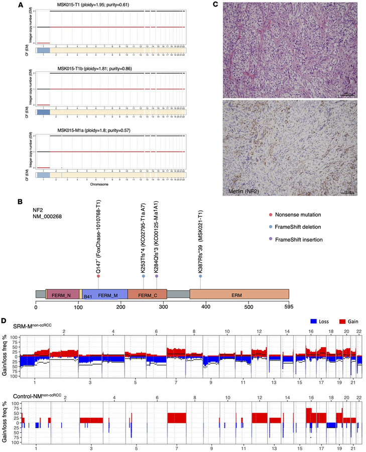 Genomic characterization of metastatic non–clear cell small renal masses...