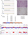 Genomic characterization of metastatic non–clear cell small renal masses re