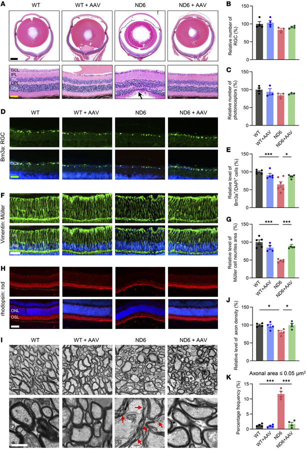 The recovery of retinal deficiency with allotopic ND6 expression.
(A) Re...