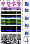 The recovery of retinal deficiency with allotopic ND6 expression.