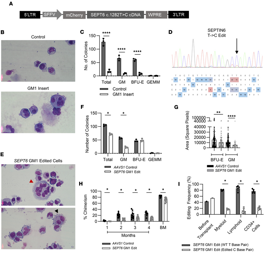 Transgenic expression of GM1 in CD34+ cells leads to defective hematopoi...