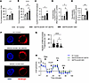 GM1 causes premature senescence in human CD34+ cells.