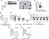 Rescue of the hematopoietic defect caused by GM1.