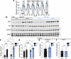 Improved endurance capacity in SkM-TSC2-5A mice is not associated with chan
