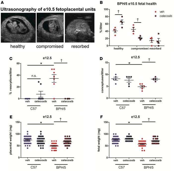Selective inhibition of Cox2 early in pregnancy improves mid-gestation f...
