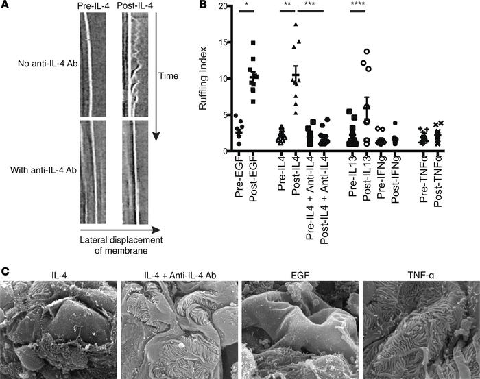 IL-4 induces podocyte membrane ruffling and widespread foot process retr...