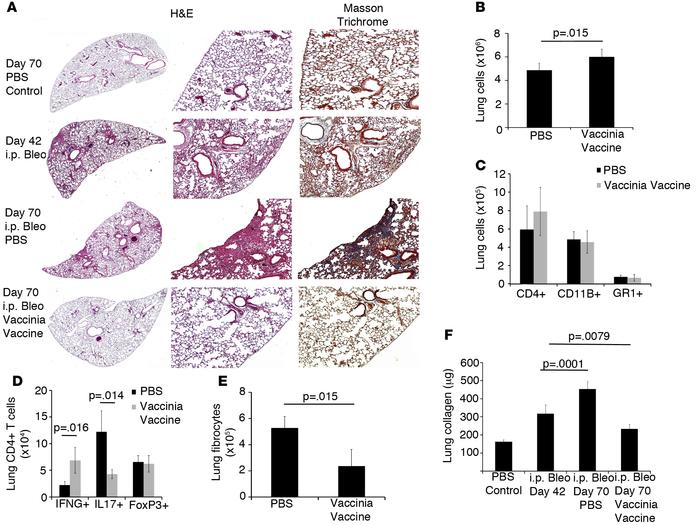 Vaccinia immunotherapy reverses lung fibrosis.
(A) Histological analysis...