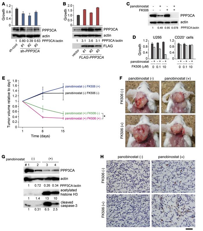 Calcineurin is indispensable for the maintenance of MM cell growth.
The ...