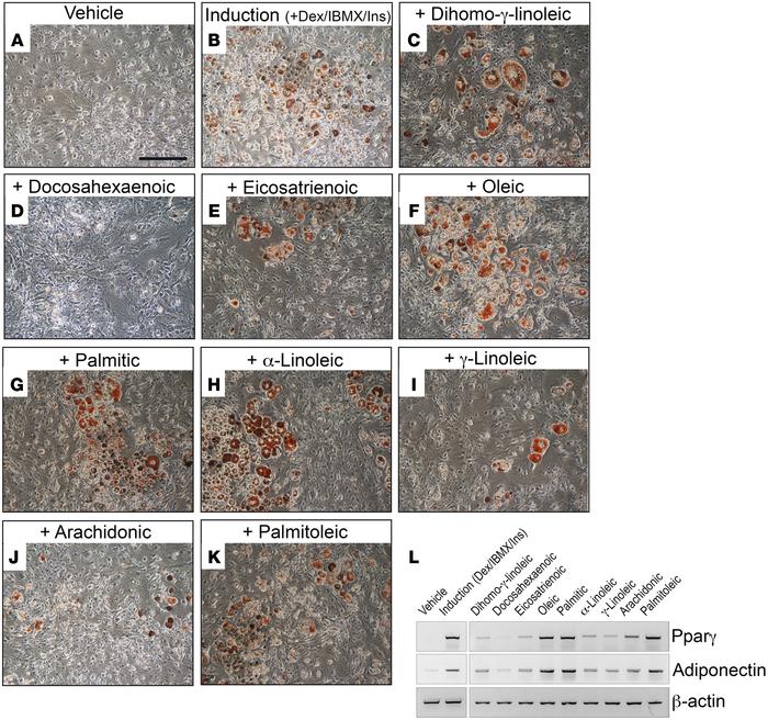 Lipids are the adipogenic stimulus in chyle.
(A and B) 3T3-L1 preadipocy...