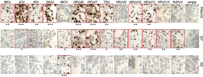 Immunohistochemical characterization of HEK293 cells expressing HPyV ear...
