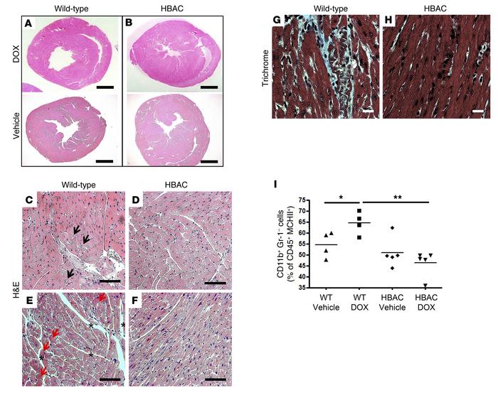 Heme oxygenase-1 overexpression protects cardiomyocytes from doxorubicin...