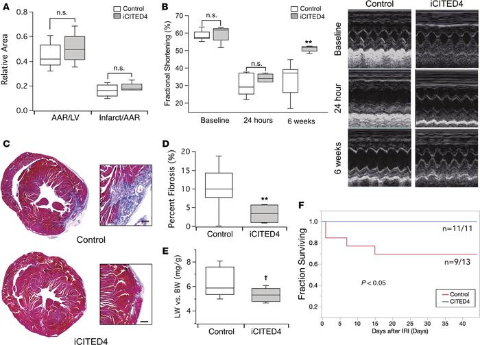 CITED4 improves cardiac remodeling after ischemia/reperfusion injury.
(A...