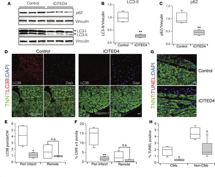 Modulation of autophagy with CITED4 expression 1 week after IRI.
(A) Wes...