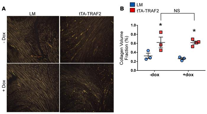 Myocardial fibrillar collagen content in tTA-TRAF2 mice.
(A) Representat...