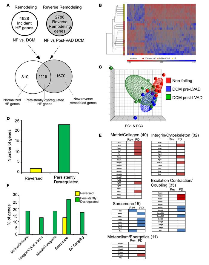 Transcriptional profiling in nonfailing (NF) human hearts (n = 8) and pa...