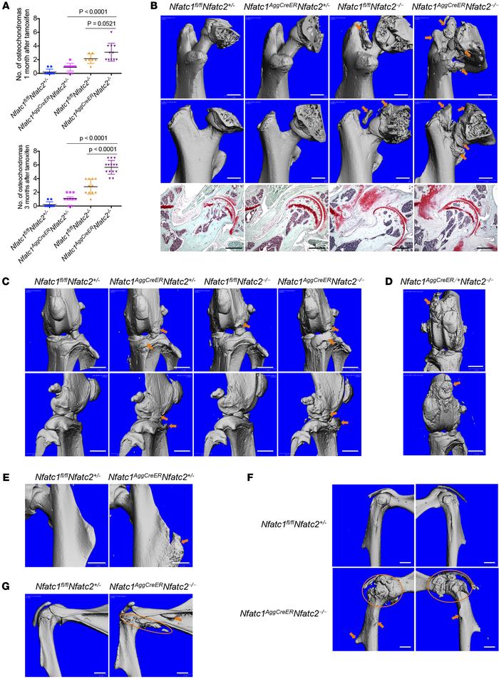 Osteochondroma formation at other locations after combinatorial deletion...
