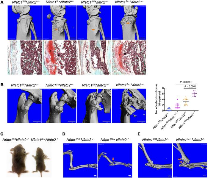 Nuclear factor of activated T cells c1 (NFATc1) deletion in Scleraxis-ex...