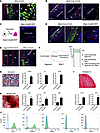Aggrecan- and nuclear factor of activated T cells c1–expressing (NFATc1-exp