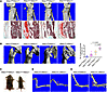 Nuclear factor of activated T cells c1 (NFATc1) deletion in Scleraxis-expre