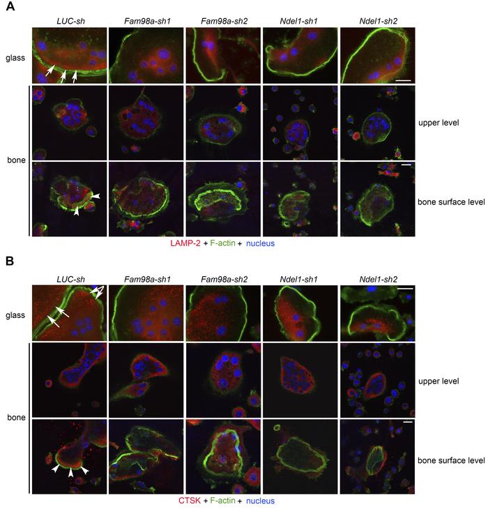 Decreased expression of FAM98A and NDEL1 inhibits the peripheral distrib...