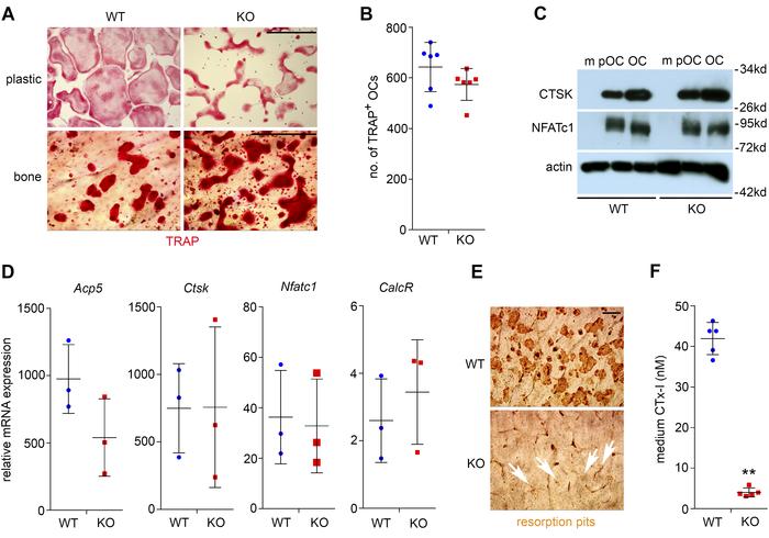 Loss of Plekhm1 attenuates bone resorption without affecting osteoclast ...