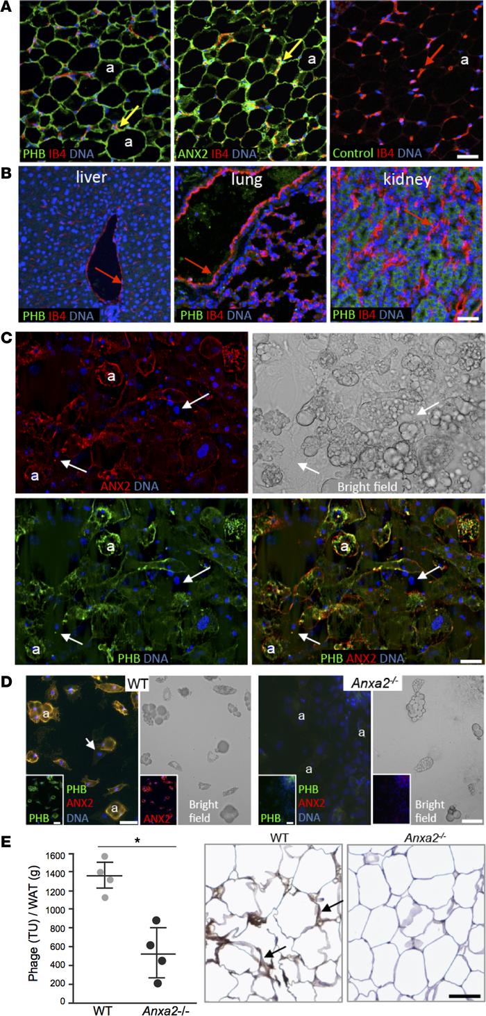 PHB and ANX2 coexpression on WAT endothelium and adipocytes.
(A) Immunof...