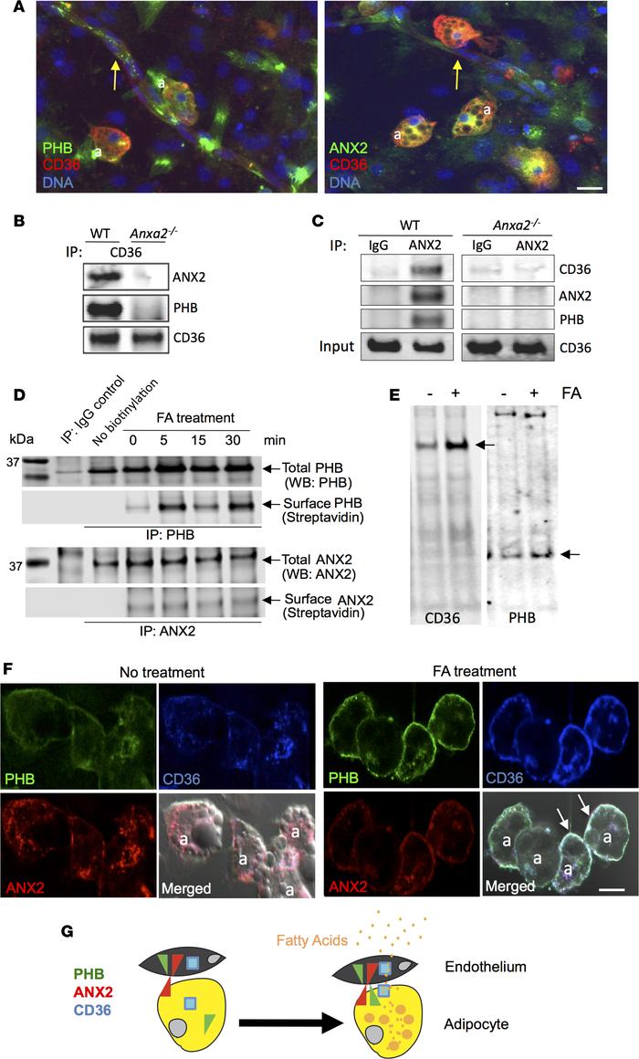 FA treatment induces plasmalemmal interaction of ANX2, PHB, and CD36.
(A...