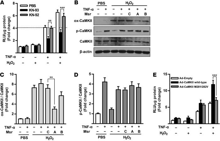 CaMKII Met-281/282 oxidation contributes to NF-κB activation in endothel...