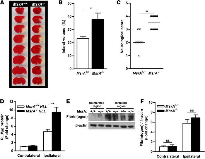 
MsrA–/– mice exhibit increased susceptibility to cerebral ischemia/repe...