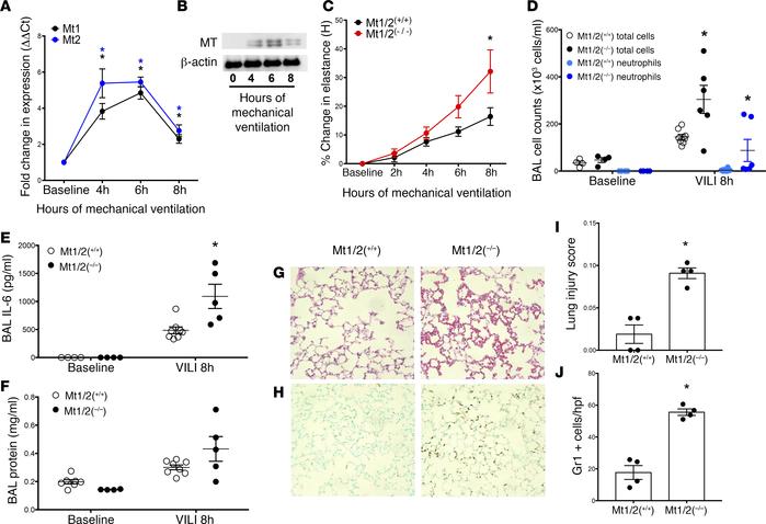 Mt1/2-deficient mice exhibit enhanced lung injury in response to ventila...