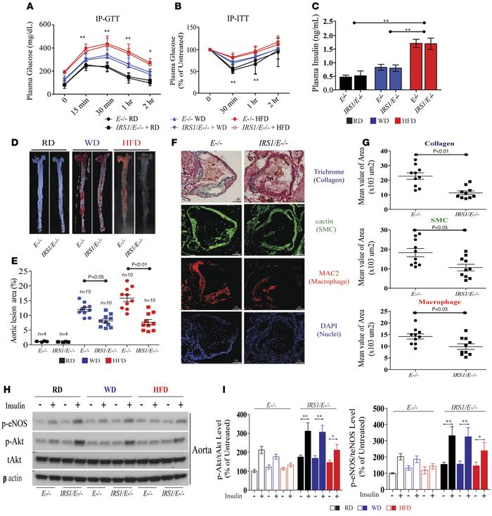 Analysis of the extent of atherosclerosis and its complexity in Irs1/Apo...