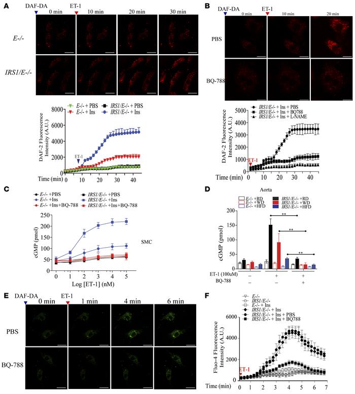 NO production in EC from Irs1/Apoe–/– mice and its relationship to EDN1 ...
