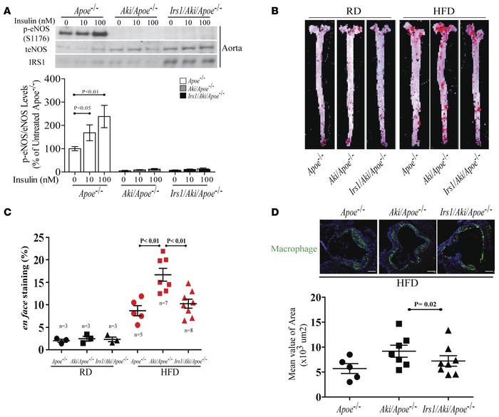 Characterization of NO production in EC from Irs1/Aki/Apoe–/– mice with ...