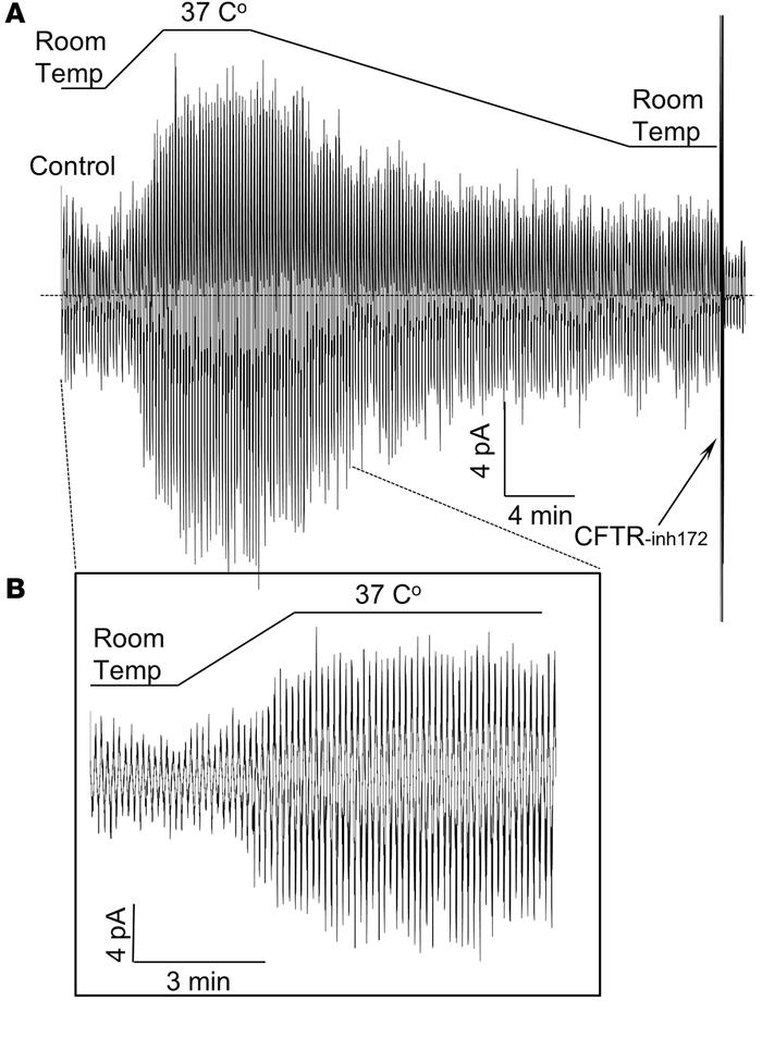 Thermal stability of mutant P67L cystic fibrosis transmembrane conductan...