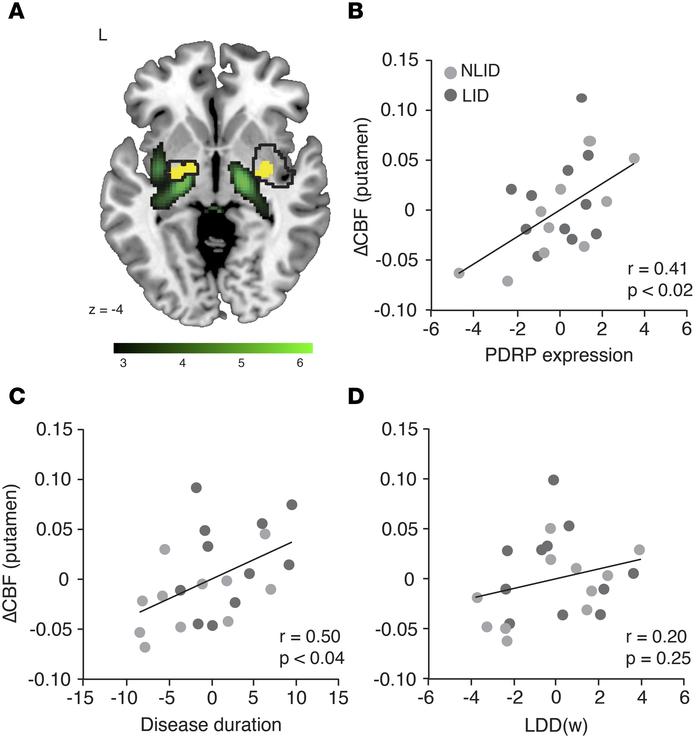 Clinical and network correlates of the putamen vasomotor response to lev...