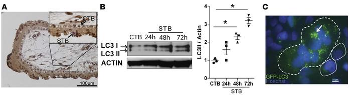 The baseline level of autophagy is higher in syncytialized than nonsyncy...