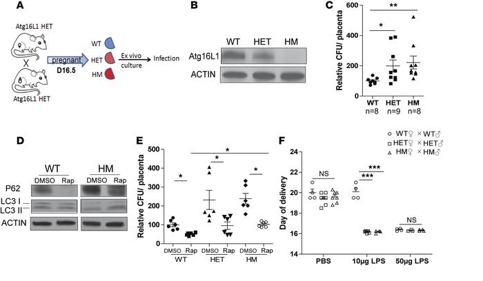 
Atg16l1-deficient mice are susceptible to placental infection and LPS-i...