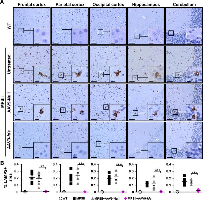 
						Correction of lysosomal distention in the CNS of MSPII mice by in...